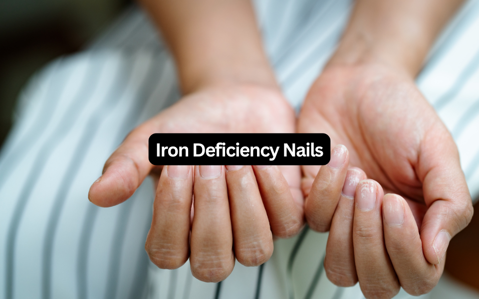 Iron Deficiency Nails