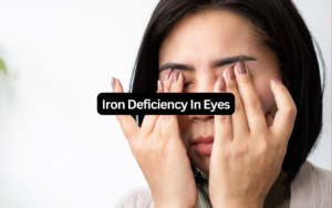 Woman rubbing her eyes with both hands, illustrating discomfort caused by iron deficiency in eyes