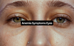 Anemia symptoms eyes text overlay on a close-up of a woman's hazel eyes and lower eyelid area